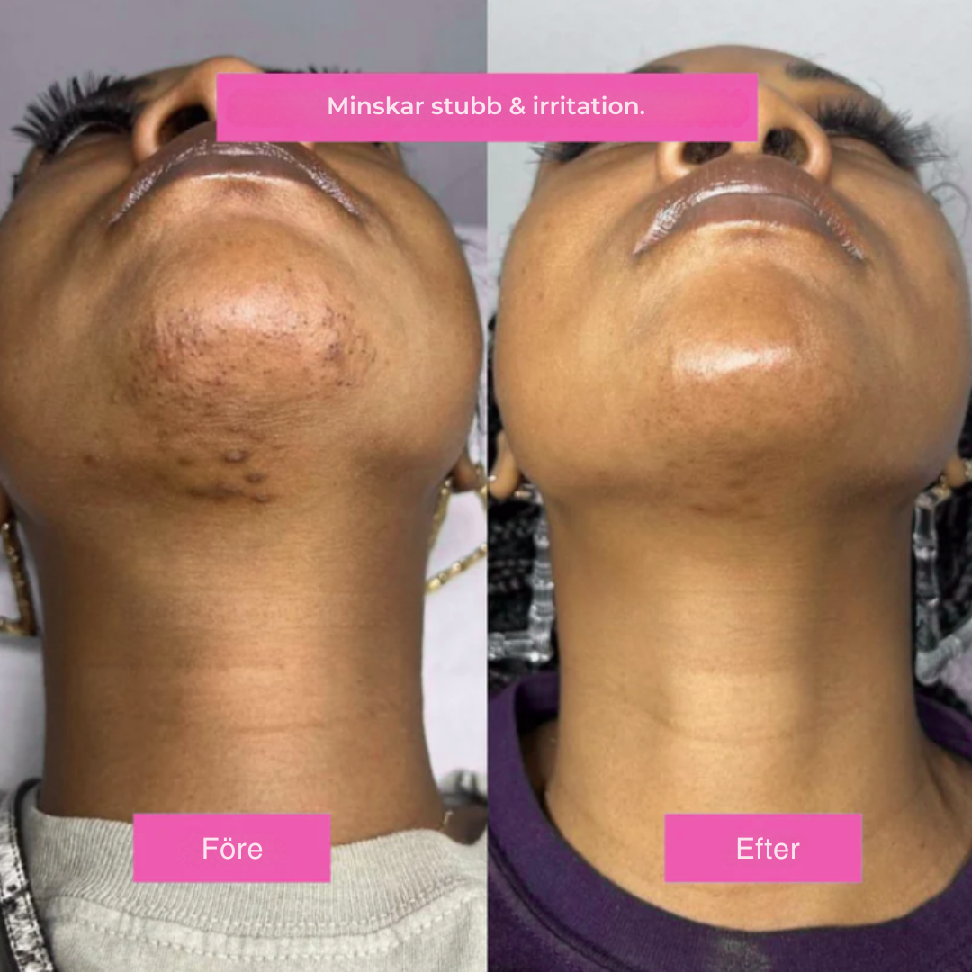 Hårborttagningsolja - Naturligt len hud utan rakhyvel