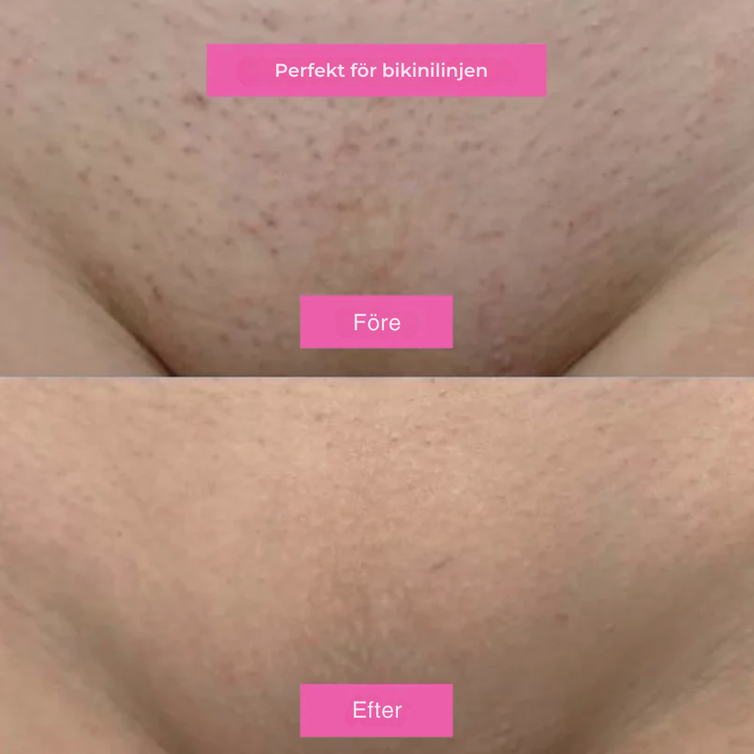 Hårborttagningsolja - Naturligt len hud utan rakhyvel