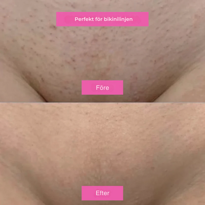 Hårborttagningsolja - Naturligt len hud utan rakhyvel